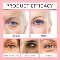Esencia de Ojo Retinol OUHOE Debilita Bolsas de Ojos, Hidrata y Levanta Piel - details 1