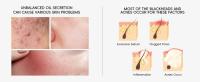 Juego de cuidado de la piel de árbol de té, juego de cuidado de la piel facial juvenil de 5 piezas, incluyendo limpiador facial, tóner, crema de gel, adecuado para adolescentes y hombres y mujeres - details 1