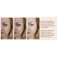 Masajeador Facial - Anti-envejecimiento LED Luz Roja Terapia Masajeador Cara - Máquina Facial para Antiarrugas y Reafirmante, Rejuvenecimiento Facial, Cuidado Facial - details 4