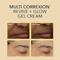 RoC Vitamin C Gel Cream Before & After
