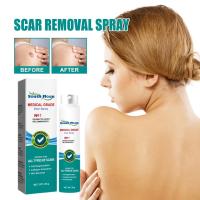 Spray para eliminar cicatrices, cuidado de cicatrices, Reduce la formación de cicatrices, cicatrices que se desvanecen, cicatrices de acné, cicatrices quirúrgicas y estrías, Spray para eliminar cicatrices - details 3