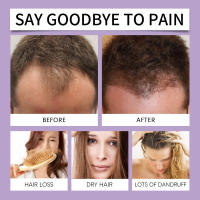 Esencia HOEGOA, cabello fuerte, grueso, esponjoso, hidratante, reparador del cuero cabelludo, esencia para el cuidado de la raíz y el cabello - details 8