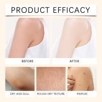 Crema hidratante para la piel que hidrata y nutre la piel para enrojecimiento, sequedad y sequedad facial. - details 8