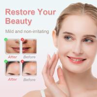 Kit de Vacío para Eliminar Puntos Negros Herramienta Extractora de Pores con 3 Niveles de Succión, 5 Probos, Recargable por USB, Adecuado para Mujeres y Hombres - details 8