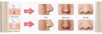 Cepillo de limpieza facial eléctrico