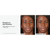 Before & after