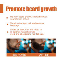 EAST MOON Aceite esencial para el cuidado hidratante de la barba de hombres de crecimiento fuerte y grueso - details 3