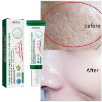 Suero corrector de manchas oscuras, crema blanqueadora hidratante para la piel Facial, Reduce las pecas, la opacidad, el acné y la melanina - details 1