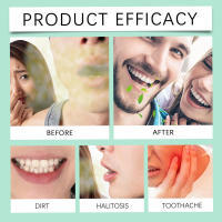 Limpieza Suave Limpieza de Dientes, Refresca el Aliento, Gotas para el Cuidado Bucal Diario - details 11