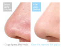 Cepillo Facial de Silicona Eléctrico Recargable por USB, Impermeable, Limpieza Profunda, Exfoliación y Masaje, Adecuado para Piel Sensible Herramienta de Cuidado de la Piel de Belleza - details 6