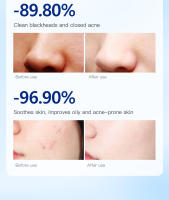 Gongpei Provitamina B5 Mascarilla limpiadora con ácido salicílico Limpieza profunda para eliminar puntos negros y reducir los poros - details 8
