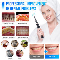 Removedor de Cálculo Dental ultrasónico, Limpieza de dientes, escalador, eliminador de Sarro Dental, cuidado Bucal - details 2