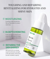 Suero reparador de enrojecimiento Facial, mejora la sequedad de la piel sensible, loción hidratante, eliminación de rosácea, Cosméticos Coreanos - details 5