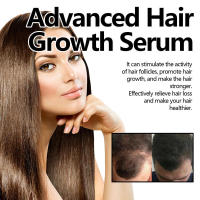 Loción Esencia Hidrata el Cabello, Fácil de Absorber, Fuerte, Flexible, Cuidado del Cabello, Aceite Esencial para el Cuidado del Cuero Cabelludo - details 6