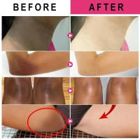 Crema blanqueadora corporal, blanqueador rápido, partes privadas, aclara las axilas, piernas, rodillas, melanina, áreas íntimas, elimina las manchas, belleza y salud - details 1