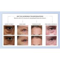 Plexaderm Quick Reduction Eye Serum: reduce visiblemente las bolsas de los ojos, las arrugas, las ojeras, las líneas finas y las patas de gallo al instante. - details 2