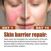 Crema Reparadora para Rojos Hidratante y Calmante para Piel Sensible Adiós a la Piel Seca - details 3