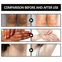 Jabón blanqueador corporal, jabón blanqueador para axilas y rodillas, eliminación de piel de pollo, eliminación de manchas oscuras, piel muerta, hidrata, ilumina el cuidado del cuerpo - details 0