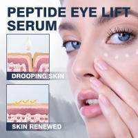 Séral de Ojos de Ácido Hialurónico Adiós a las Ojeras, Desvanece Bolsas, Hidratante y Masajeador de Piel Herramienta de Cuidado de la Piel Facial - details 1
