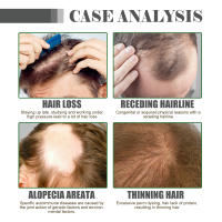 El aceite de esencia puede reparar y proteger, mejorar el daño irritante, fortalecer el cabello, hidratar el cabello - details 6
