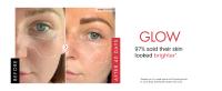 Crema para eliminar arrugas, Retinol, cara, antienvejecimiento, reafirmante, levantamiento, desvanecimiento, líneas finas, mejora la sequedad de la piel, hidratante, ilumina el cuidado de la piel - details 2