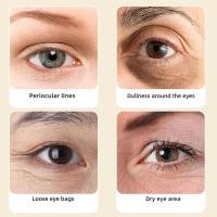 Esencia de Ojo Luteina VC Rodillo de Cuidado de Piel para Ojos Dulces y Brillantes - details 3