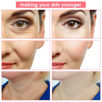 Masajeador Facial de radiofrecuencia, máquina de estiramiento Facial, terapia de fotones Led, dispositivo de belleza antiarrugas de microcorriente - details 8
