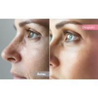 Aparato Radiofrecuencia Facial 5 en 1, Masajeador Facial Eléctrico Reafirmante, Limpieza Facial, Antiarrugas, Rejuvenecimiento, Radiofrecuencia Facial y Corporal Profesional - details 2