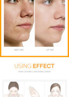 Suero Facial 17ml con Vitamina C,E y Hialurónico Anti-arrugas, Volumen, Anti-edad, Hidratante, Orgánico - details 10