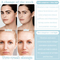 1 afeitadora facial para extrusión fría y caliente de 45 pulgadas en la cara, el cuello y el cuerpo, aparatos de belleza themomostat tiple color Care eve, para hombres y mujeres - details 2