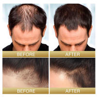 El aceite de rosa para cabello grueso hidrata, nutre el cabello, alivia la sequedad, fortalece la dureza, solidifica y previene. - details 8