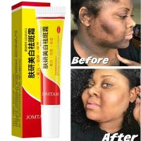 Crema iluminadora facial, niacinamida, Reduce el cloasma, melasma, melanina, desvanece las líneas finas, aclara la piel oscura, suero para el cuidado, crema iluminadora - details 1