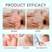 Wiieey Moisturizing Baby Body C nutre suavemente la piel, mejora la elasticidad, repone la humedad e hidrata el cuerpo. - details 10