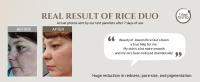 rice MASK