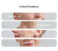 Máquina portátil de belleza para estiramiento de la piel, estiramiento facial RF, para uso doméstico, máquina Facial de radiofrecuencia - details 1