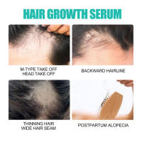 Jayswing Dense Essence repara, hidrata, cabello seco y encrespado, previene el cuidado del cabello para un cabello fuerte, firme y grueso. - details 4