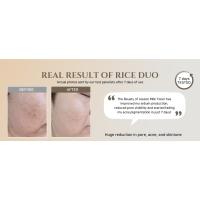rice MASK