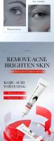 Crema para ojos eliminadora de gránulos de grasa, crema firme antiinflamatoria, Reduce las ojeras, desvanece las líneas finas, barrera de reparación Sk - details 8