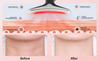 neck tightening device microcurrent facial device microcurrent multifunctional facial massager