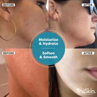Suero de ácido hialurónico TruSkin para rostro + 7 ingredientes ultrahidratantes: el mejor suero facial para hidratar, rellenar visiblemente la piel y suavizar el aspecto de las líneas finas, 2 fl oz - details 5