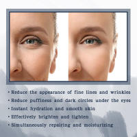 Séral de Ojos de Ácido Hialurónico Adiós a las Ojeras, Desvanece Bolsas, Hidratante y Masajeador de Piel Herramienta de Cuidado de la Piel Facial - details 4