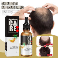 Aceite esencial de South Moon, esencia para el cuero cabelludo, cuidado del cabello, líquido de masaje nutritivo - details 0