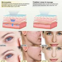 Sistema de microagujas automático, herramienta de terapia para el cuidado de la belleza,masajeador facial por radiofrecuencia,dermapen - details 7