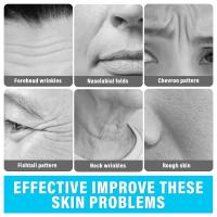 Scttomon Masajeador Facial Herramienta de Eliminación de Arrugas para Suavizamiento de Cara y Cuello Equipo de Belleza Efectivo - details 3