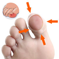 Separador de dedos grandes de gel de silicona, aplicador Protector de dedo, eliminador de callos de maíz, Corrector de juanetes, herramientas de pedicura, tubo para aliviar el dolor - details 21