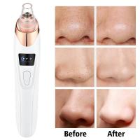 Limpieza Facial Profunda Máquina Eliminadora De Puntos Negros Y Acné Eléctrica Herramienta De Cuidado De La Piel Con Vacío - details 7
