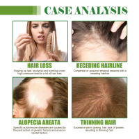 West&Montr hidrata y cuida el aceite esencial para el cuidado del cabello seco, hidratante y suave - details 5