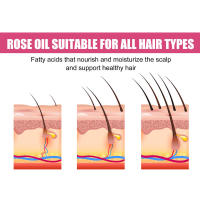El aceite de rosa para cabello grueso hidrata, nutre el cabello, alivia la sequedad, fortalece la dureza, solidifica y previene. - details 6