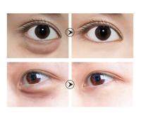 Parches Para Los Ojos Bolsas y Ojeras, Máscara Para Los Ojos De Colágeno, Ácido Hialurónico, Retinol, Perla Negra, Vitamina C,Rosa,60 uds. - details 3