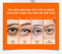 Crema de Ojos con Vitamina C Eliminación de Ojeras, Reducción de Hinchazón, Hidratación - details 1
